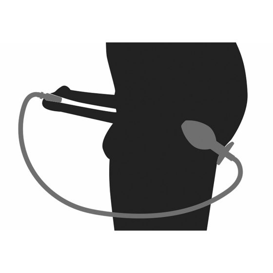 Dopul Urină-în-Anus - dildo anal de oțel golghiat cu dilatator uretral