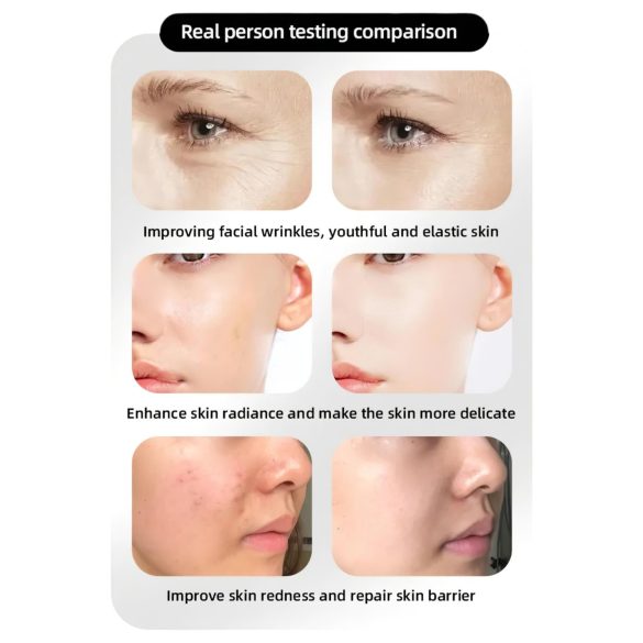 Masca LED Photon Rejuvenation pentru îngrijire facială